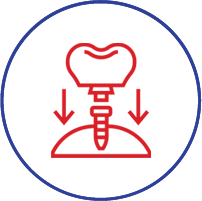 Dental implant icon showing tooth with arrows pointing downward into jawbone structure.