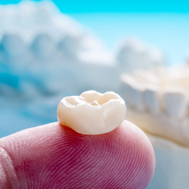 Dental crown held on fingertip against blue sky background, symbolizing cosmetic dentistry services.