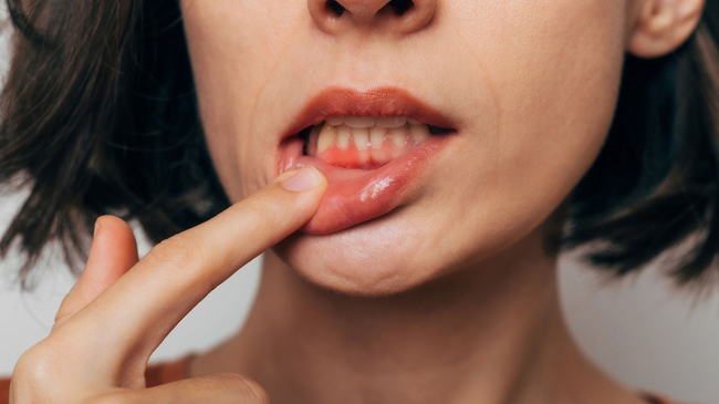 Close-up of person pointing to lips, demonstrating oral health or dental care concern.