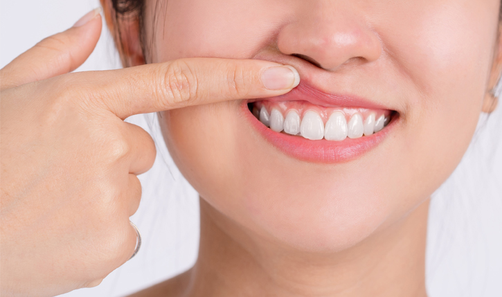 Woman pointing to her smile showing healthy white teeth against white background.