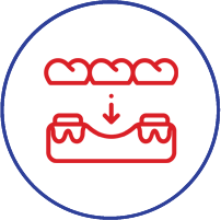 Dental compression icon showing teeth being pressed down onto gums with arrow indicator