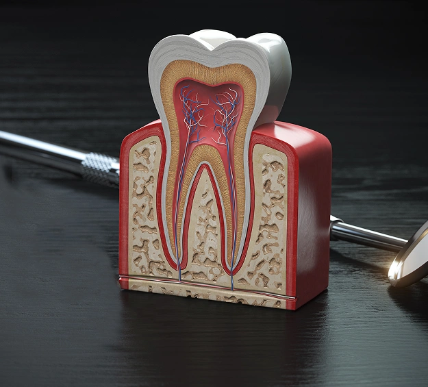 Anatomical tooth model displaying internal structure with crown on dark dental office surface.