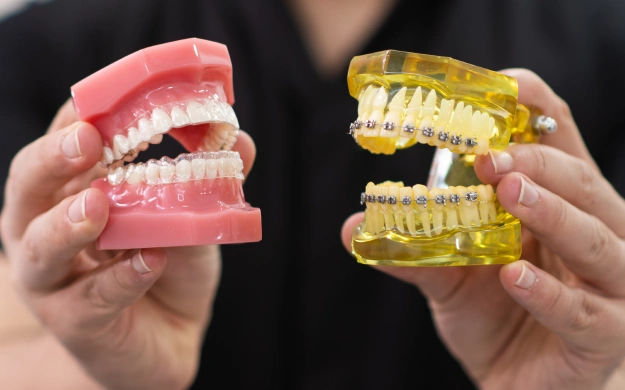 Two dental models showing teeth displayed in hands against dark background for dental education purposes.