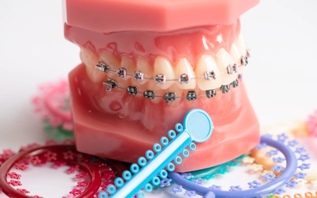 Dental model with metal braces and orthodontic tools on colorful background