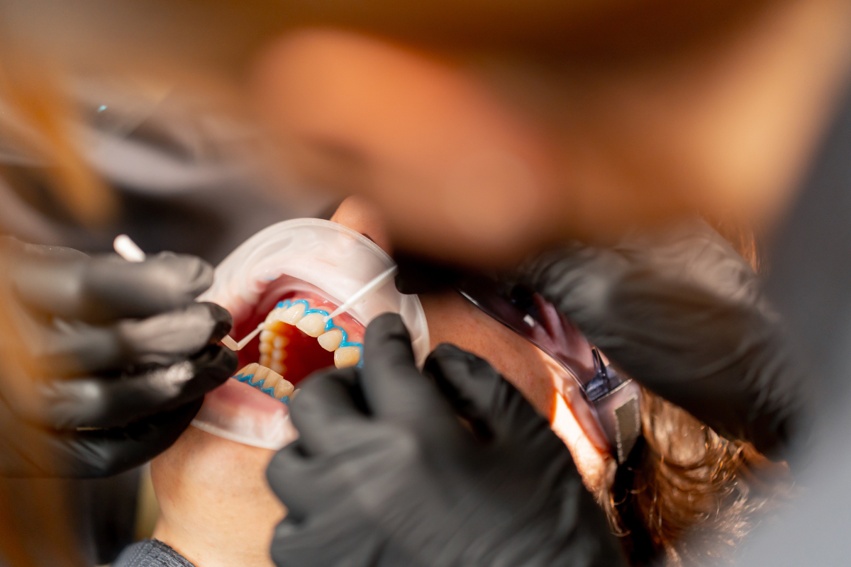 Cosmetic Dentist in Memphis
