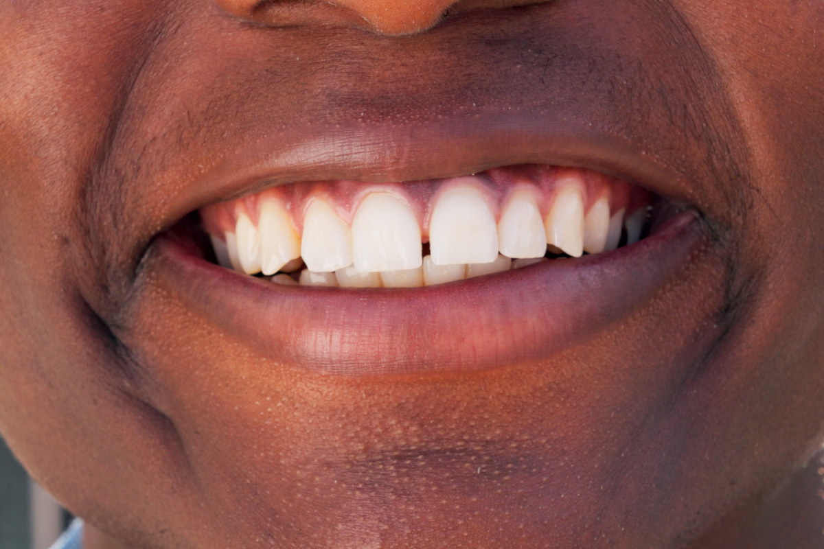 cosmetic dentist