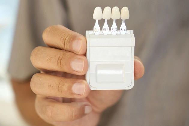 Enhance Your Smile With Dental Veneers