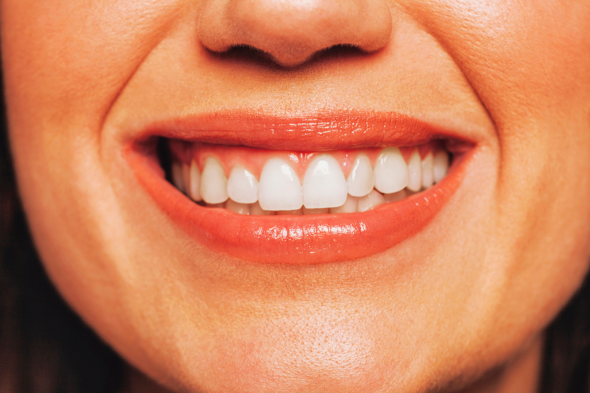 cosmetic dentistry for long-lasting smile