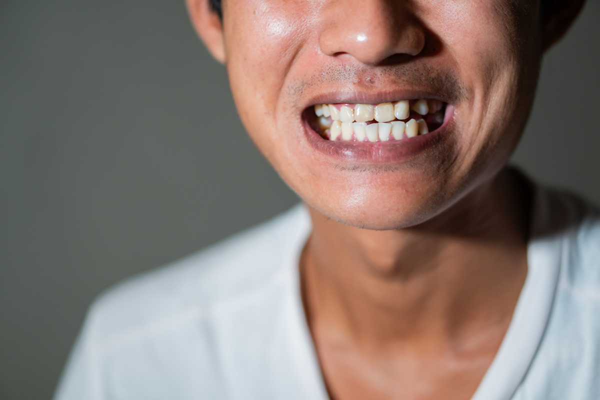 Simple Guide to a Brighter smile