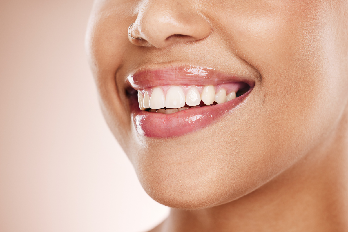 cosmetic dental treatment